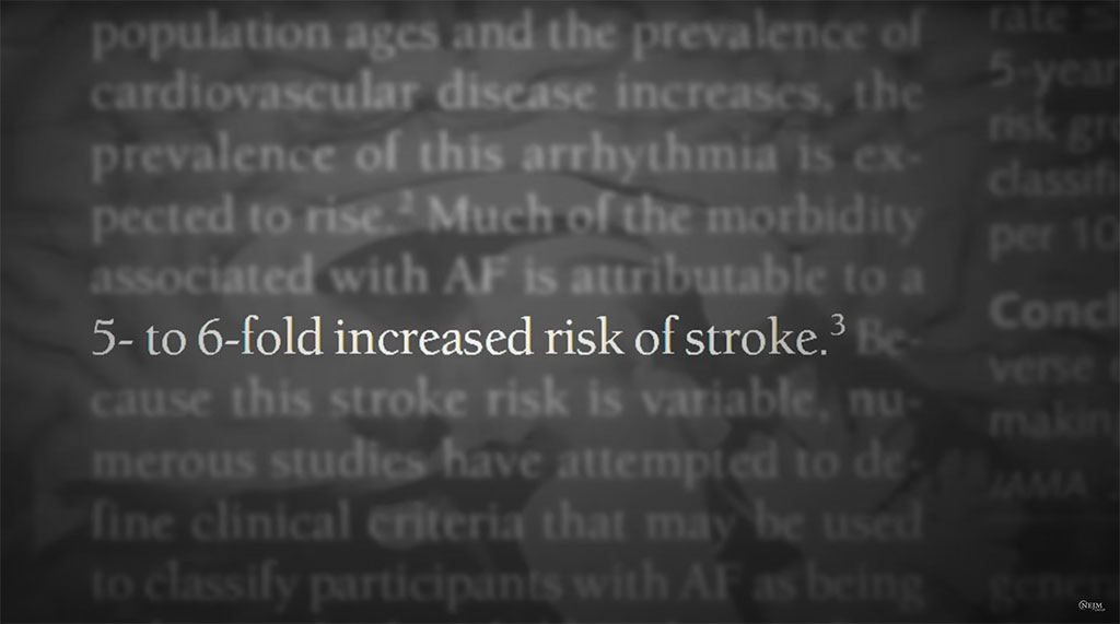 A stat about risk of stroke