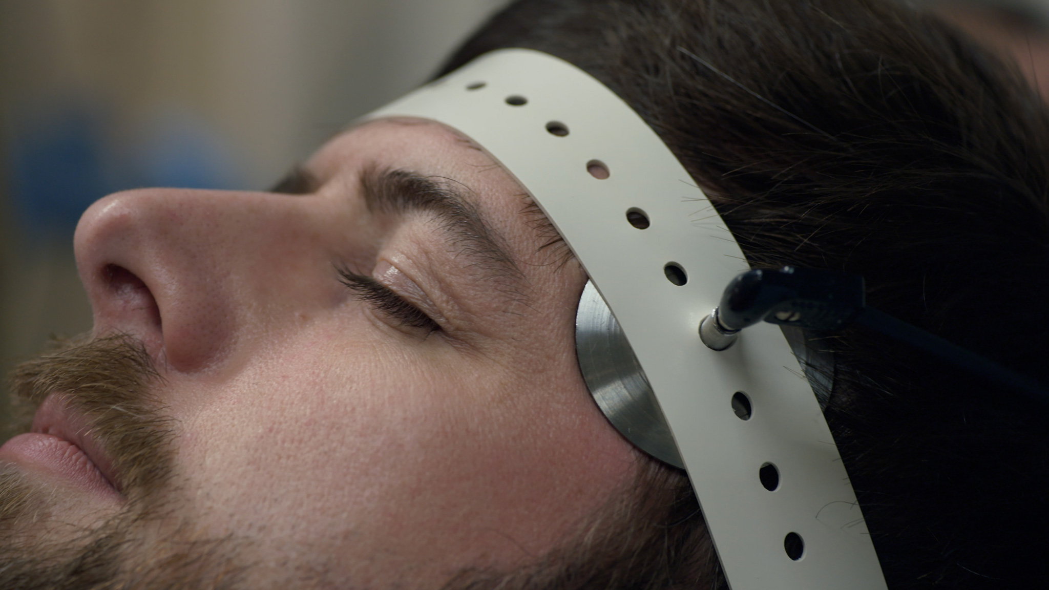 Man has electrodes placed on side of head to receive electroconvulsive therapy